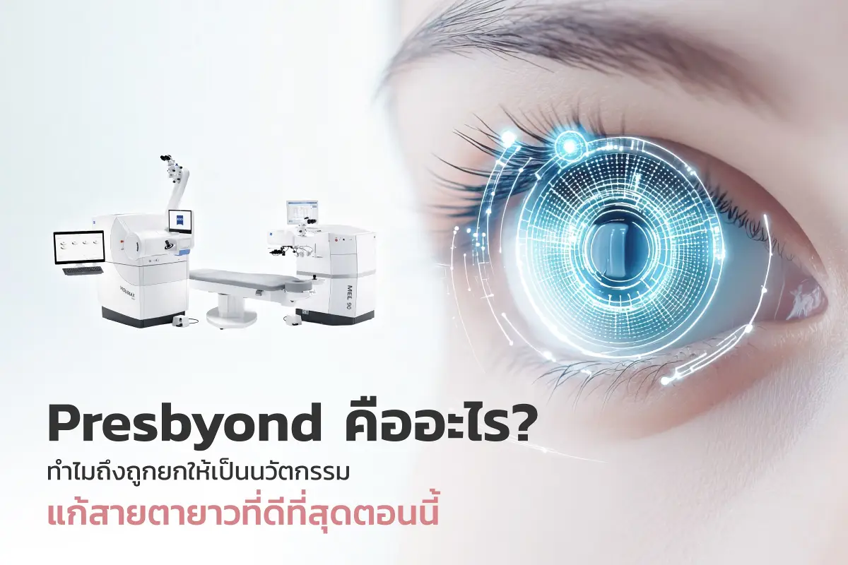 Presbyond คืออะไร? ทำไมถึงถูกยกให้เป็นนวัตกรรมแก้สายตายาวที่ดีที่สุดตอนนี้